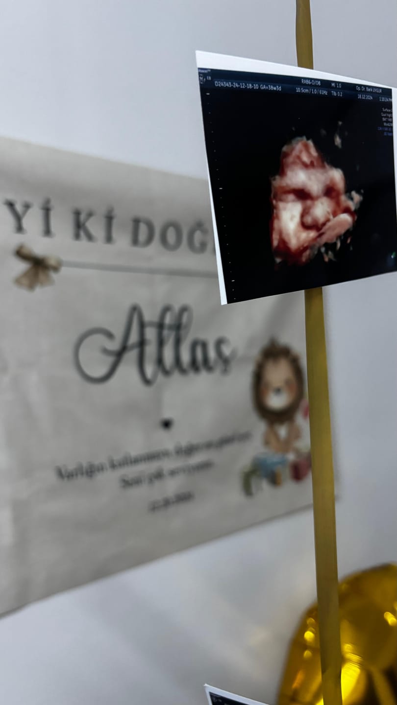 Customer photo review of Kişiselleştirilebilir Aslan Figürlü Doğum Günü Örtüsü (#108)