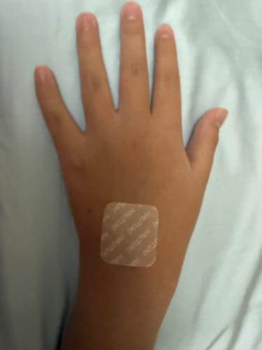 Customer photo review of HAUTUKI Growth Support Patch - 1 Month Supply (1Box)