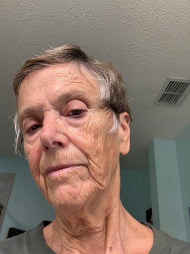 Reviewer's close-up photo of her face from an angle while using the Grass Fed Tallow & Honey Balm.