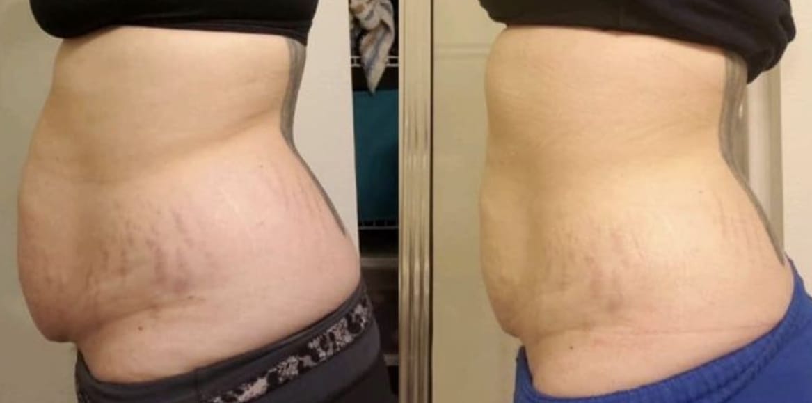 Customer photo review of Crème Raffermissante