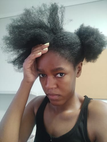 Customer photo review of Minoxidil DOUBLE ACTION FOAM, MEN ONLY 3x60ml Pack