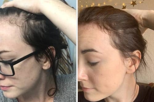 Customer photo review of Kerarose Rosemary Shampoo