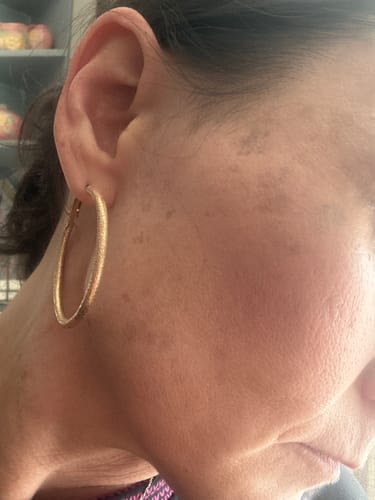 Close-up of a reviewer's cheek, showing moisturized skin in their review of the Grass Fed Tallow & Honey Balm.