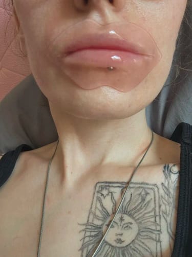Customer photo review of InstaLift Kollagen Lippenmaske 2.0