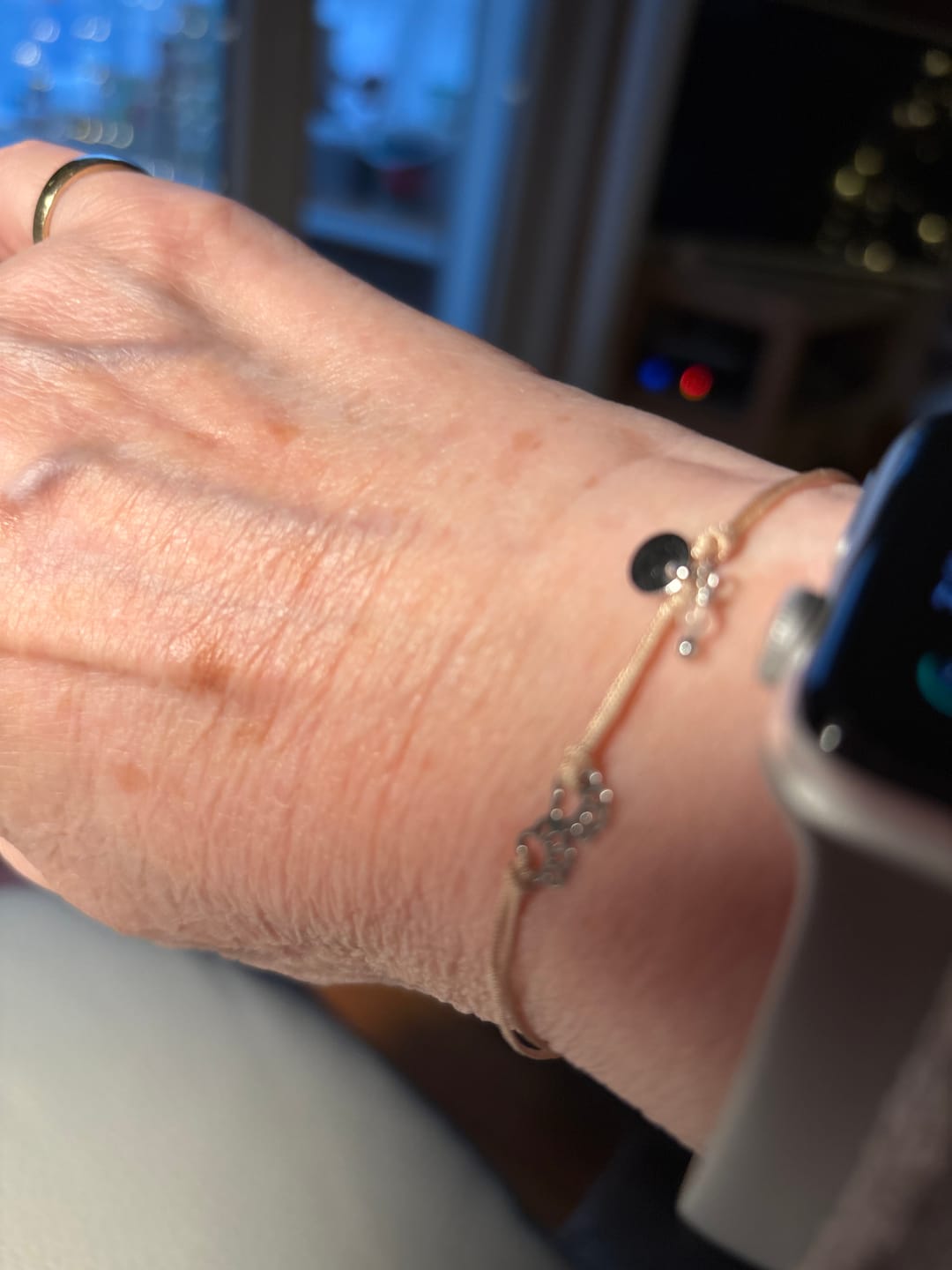 Customer photo review of Pawsitive Armband - 🐾 Vorbestellung (Versand ab ca. 20.12.)