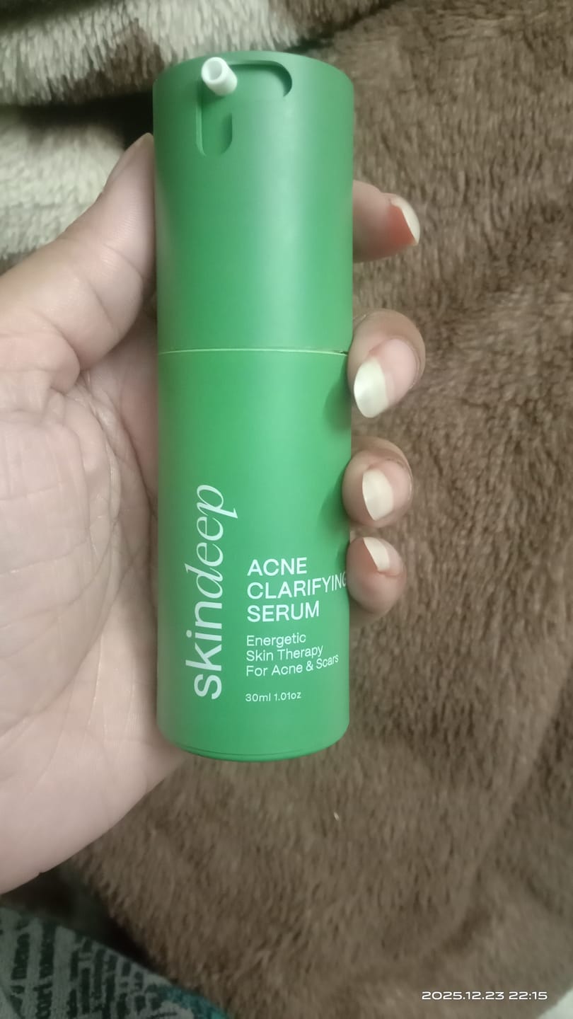 Customer photo review of ACNE CLARIFYING SERUM - Energetic Skin Therapy for Acne & Scars