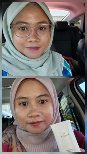 Customer's before-and-after photo showing healthier skin while holding the Water Gel UV Sunscreen in a car.