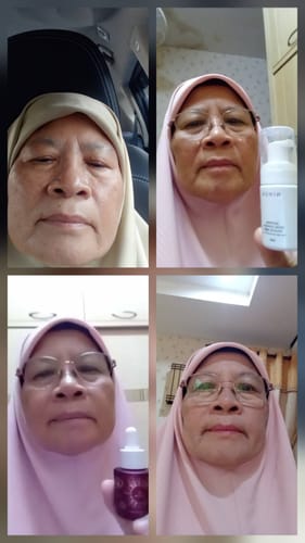 Customer collage showing their skin's progress while using the Gold Radiance Serum.