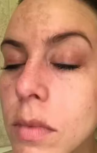 Customer photo review of LUMORA™ Copper Peptide Serum