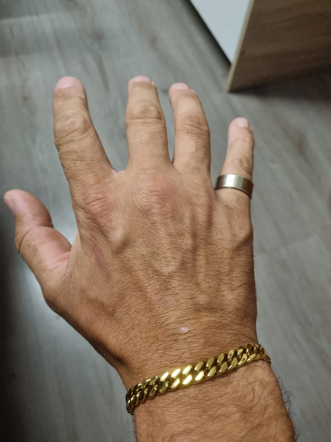 Customer photo review of LEGACY SET (GOLD) (7MM)