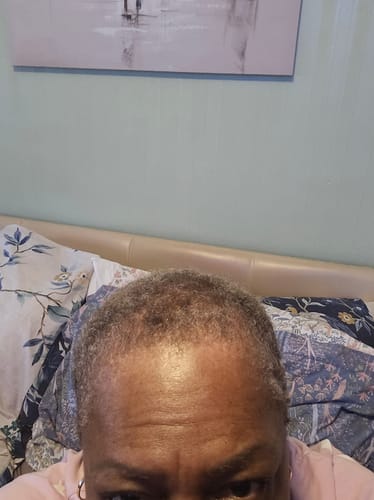 Customer photo review of Curlic Activator Pro + FREE All-Natural Growth Oil + E-Book