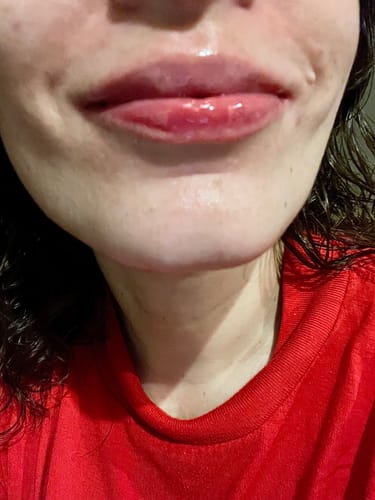 Customer photo review of PHA 5% Exfoliating Lip Serum