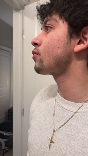 Customer photo review of Daily Skincare Duo