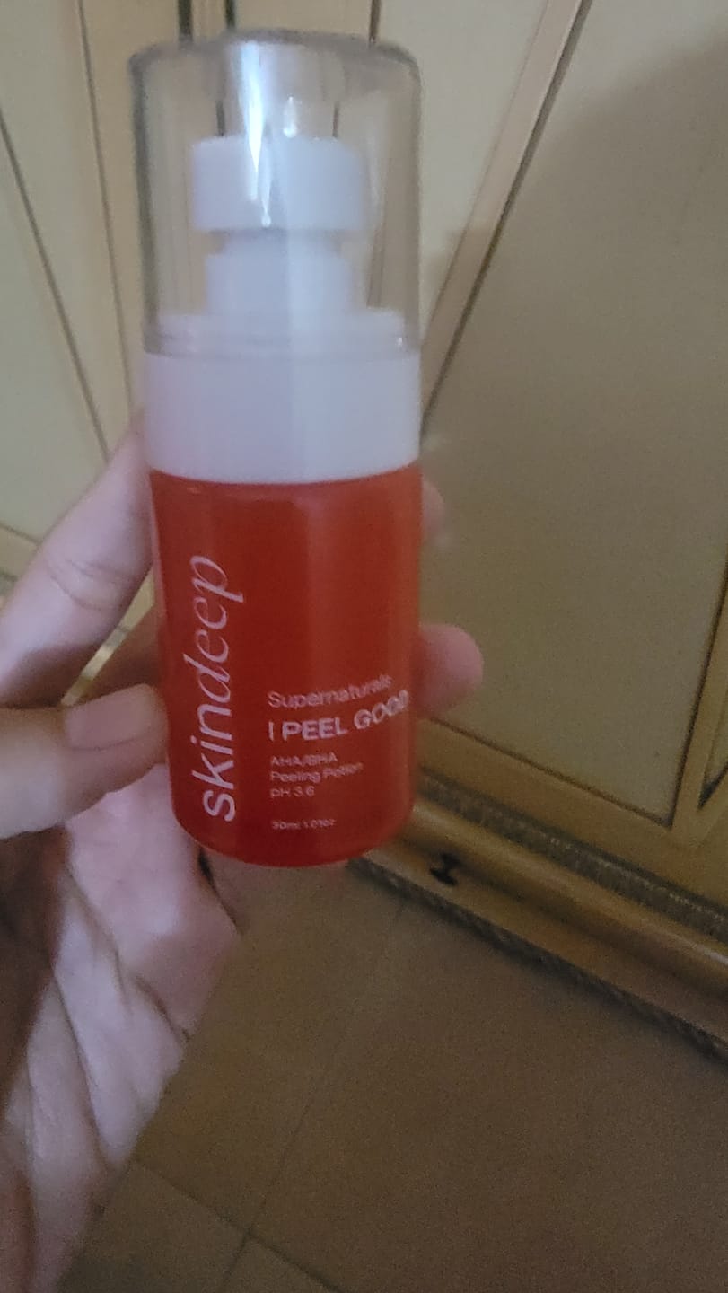 Customer photo review of I PEEL GOOD - AHA/BHA Peeling Potion