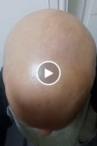 Customer video review of Seb Natural Calming Serum