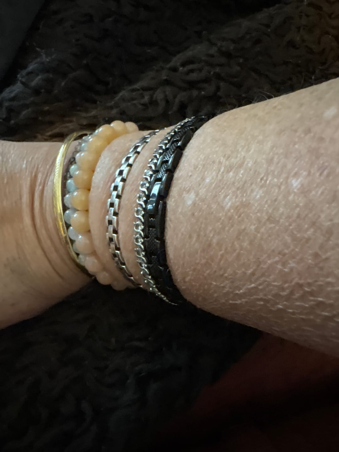 Customer photo review of Bio Bands - Metal