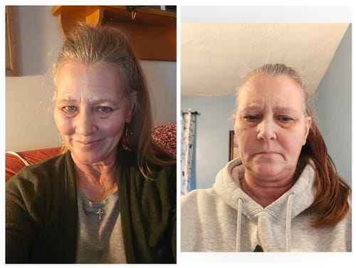 Customer photo review of Zoyava Soothe and Smooth Bundle: Cortisol 60 and Myo-Inositol 90 Capsules Supplement Bundle