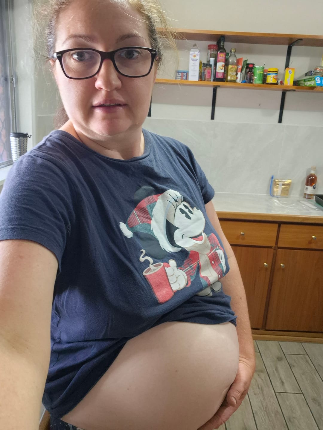 Customer photo review of New Watermelon Belly & Body Oil