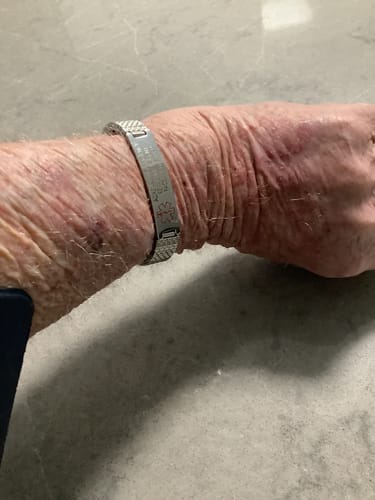 Customer photo review of Stainless Steel Medical Alert ID Stretchable Bracelet