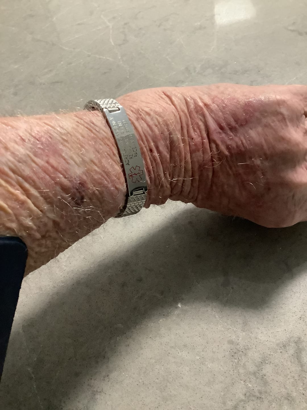 Customer photo review of Stainless Steel Medical Alert ID Stretchable Bracelet