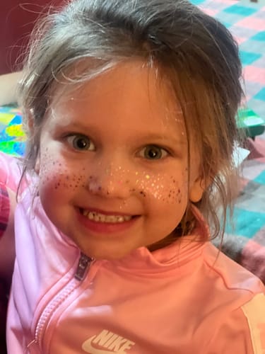 Customer photo review of Sprinkles Glitter Freckle Makeup Patches