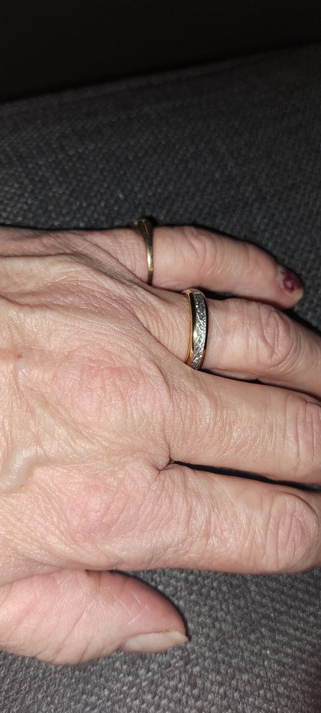 Customer photo review of The Golden Steel Wonder Ring Set