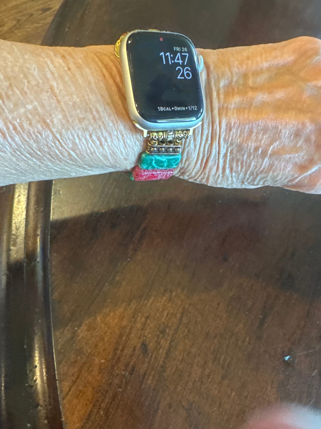Customer photo review of Christmas Wonder Stretch Apple Watch Strap