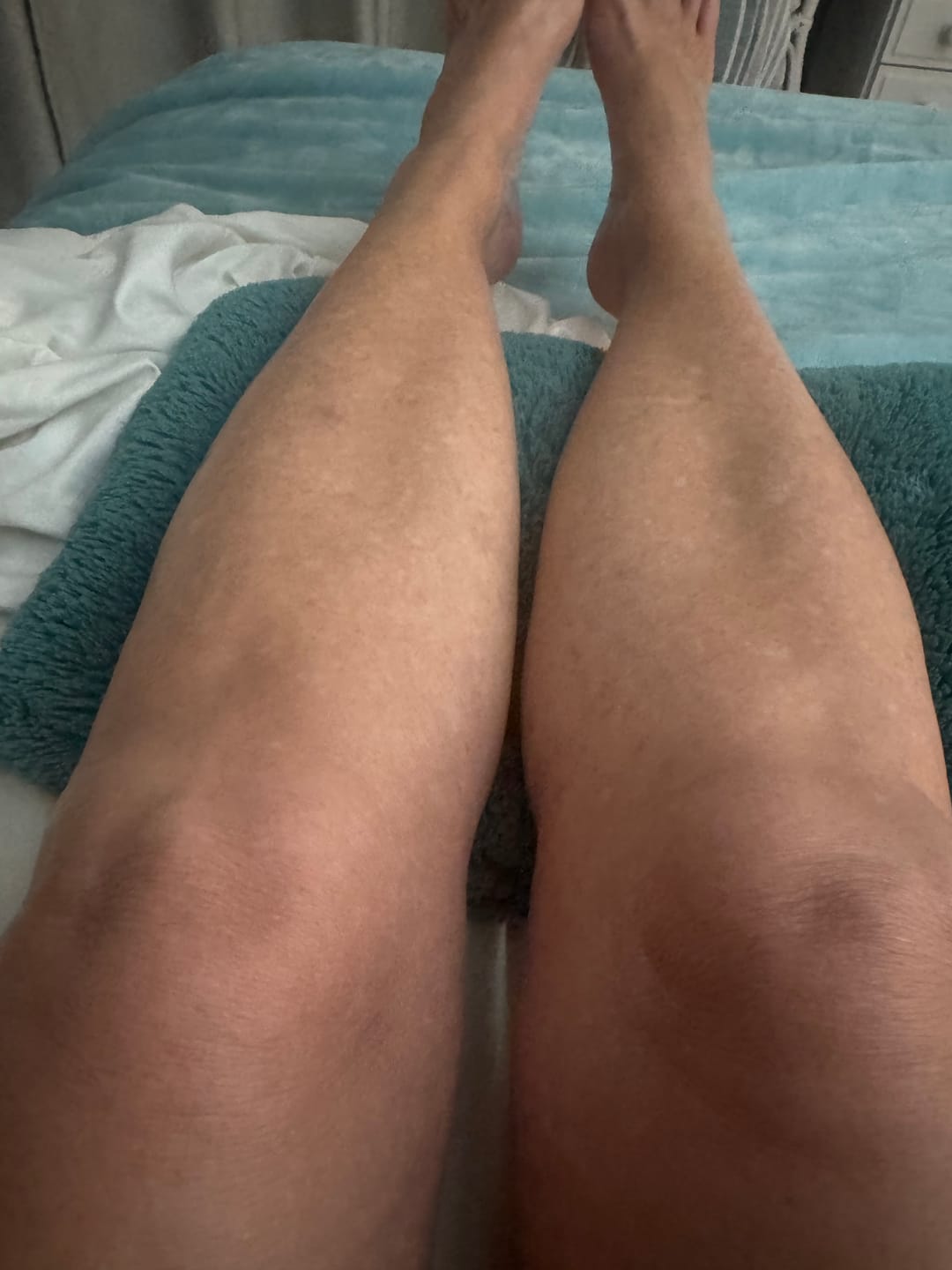 Customer photo review of Outback Pain Relief™ Oil 50ML Roll-On