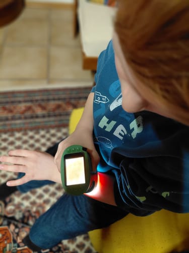 Ein Kind untersucht seinen Arm mit dem grünen Edubini Abenteuer-Mikroskop.