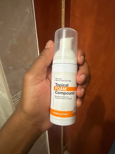 Customer photo review of Minoxidil DOUBLE ACTION FOAM, MEN ONLY 3x60ml Pack
