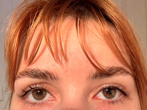 Customer photo review of KosmaLash® | Sérum Crecimiento & Anticaída