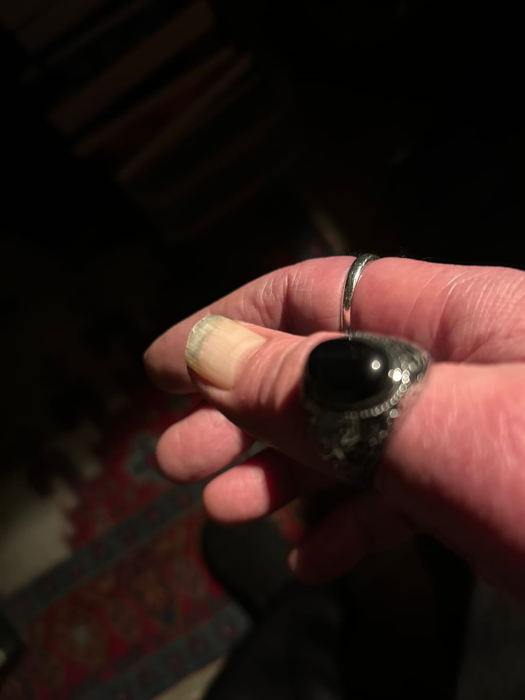 Customer photo review of BLACK EYES.