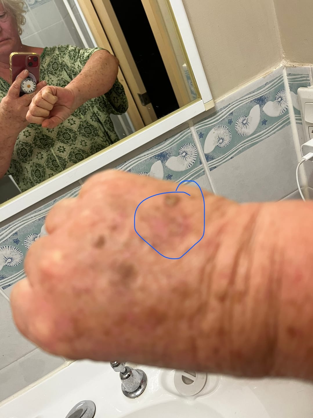 Customer photo review of MAGNESIUM SUPER STICK