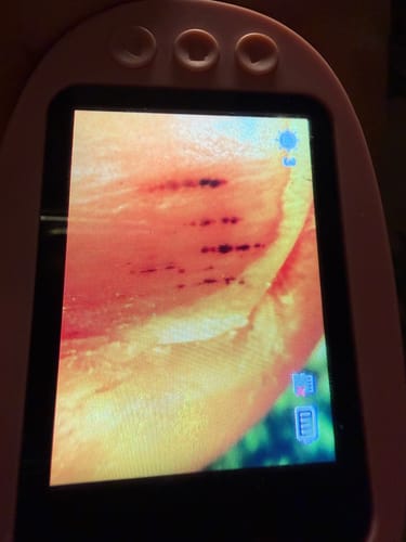 Nahaufnahme des Bildschirms des rosa Edubini Abenteuer-Mikroskops, der eine stark vergrößerte Hautpartie zeigt.