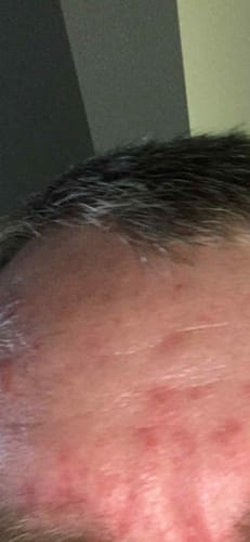 Customer photo review of Seb Natural Calming Serum