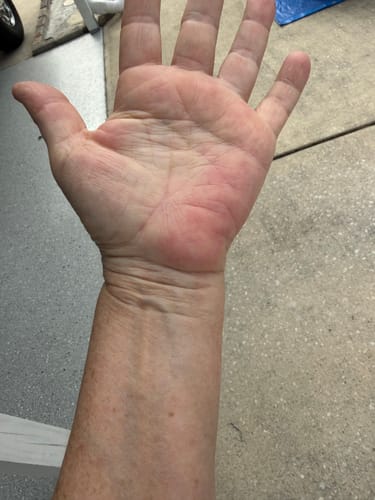 Customer photo review of Neuropathy Support Sample 4 Pack