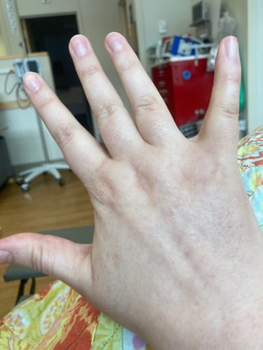 Customer photo review of Chemo Skin Care Kit