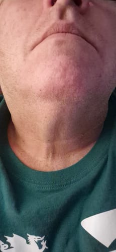 Customer photo review of Seb Natural Calming Serum