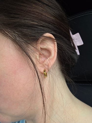 Customer photo review of Segmented Huggies