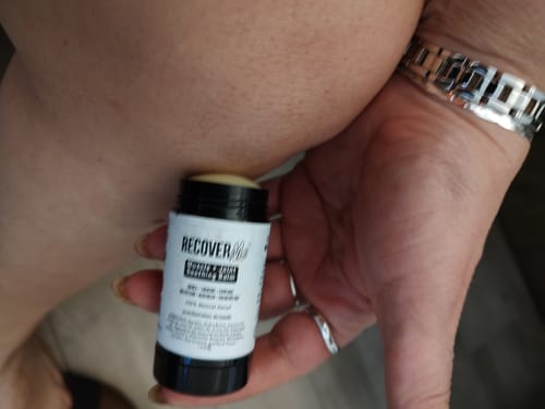 Customer photo review of RecoverMe Balm Stick