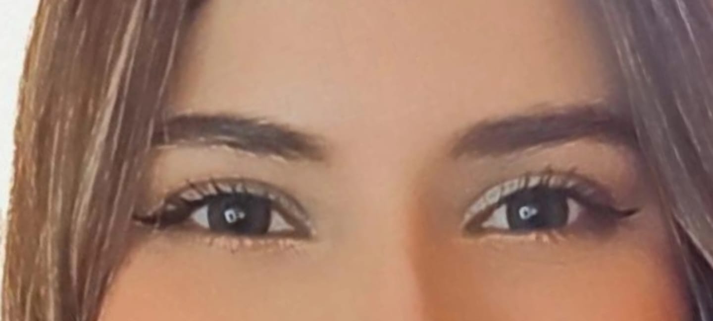 Customer photo review of Flora Green Prescription Colored Contact Lenses