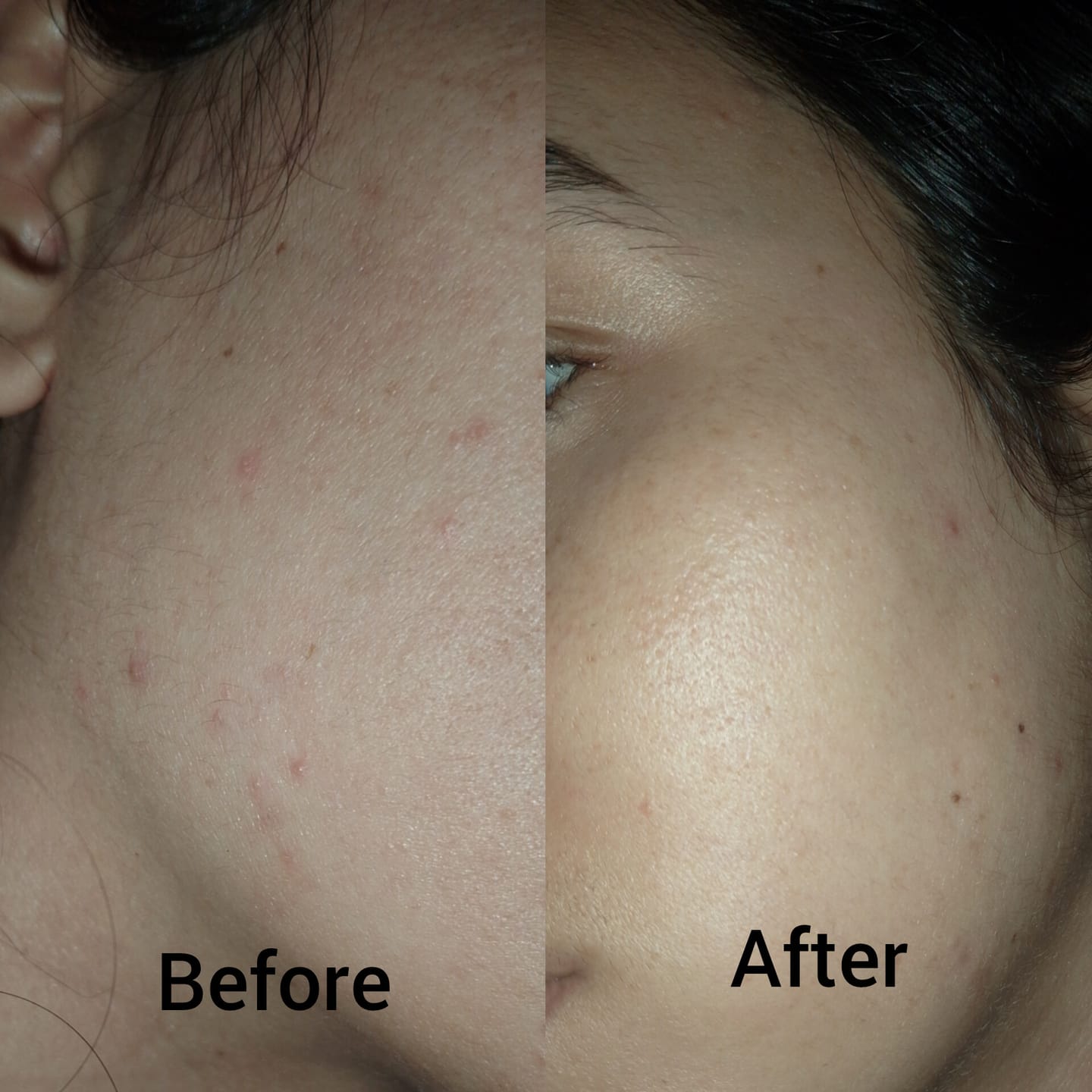 Customer photo review of Cerulic Glow Boosting Serum