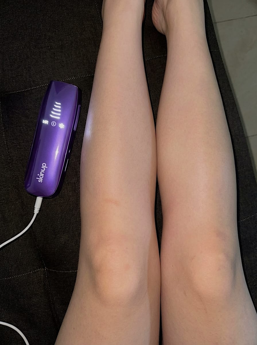 Customer photo review of SkinUp Pro