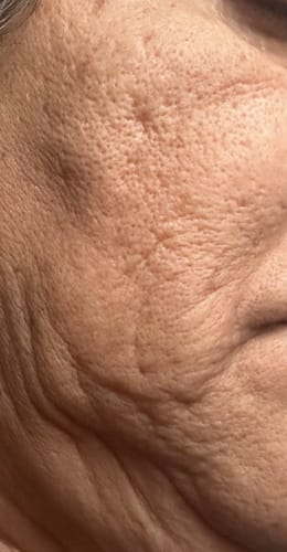 Close-up of a reviewer's cheek, showing the skin texture being treated with the F-Balm product.