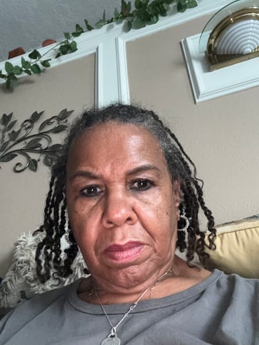 Customer photo review of Organic Hair Growth Oil