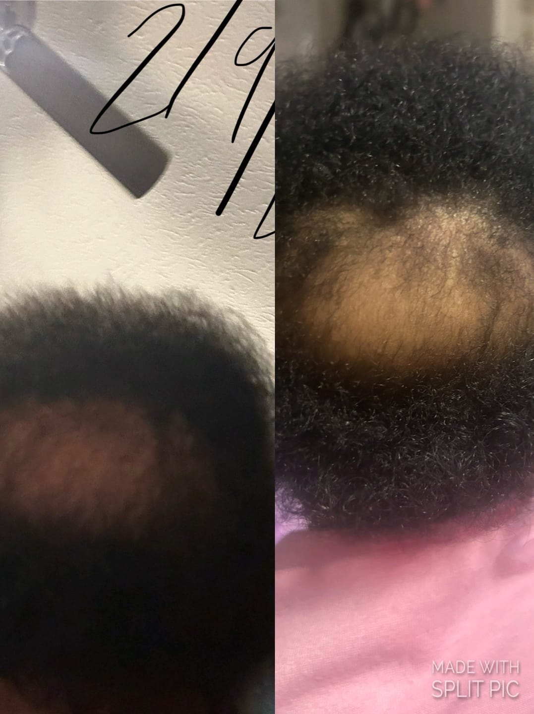 Customer photo review of I Want It All Whole Collection Kit