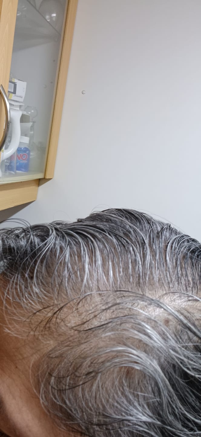 Customer photo review of SHAMPOO ANTICAÍDA FORTALECEDOR TÉ VERDE & ROMERO