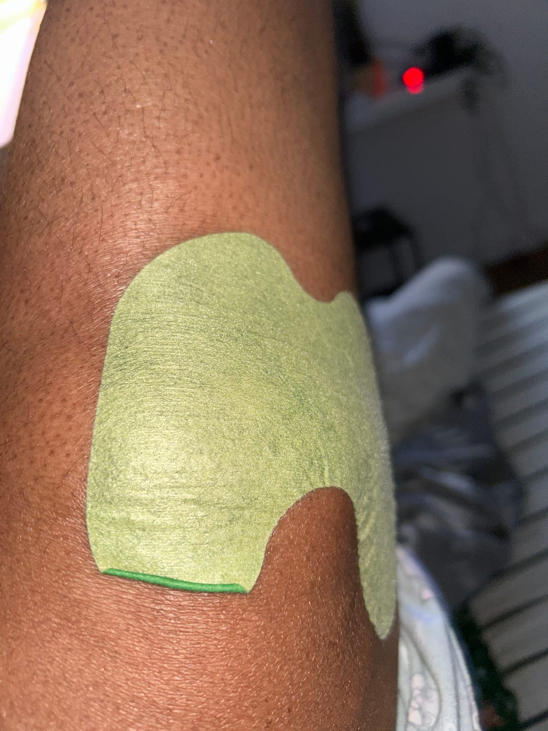 Customer photo review of Patchs anti-douleur