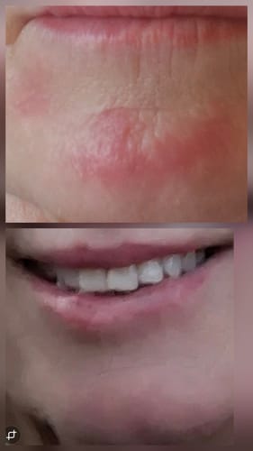 Customer photo review of Seb Natural Soothing Balm