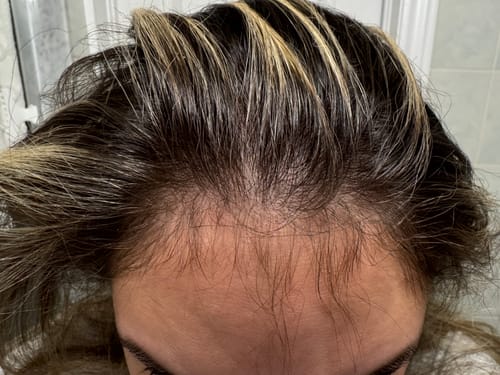 Customer photo review of TR Hair Oil Essentials Bundle ($66 value)